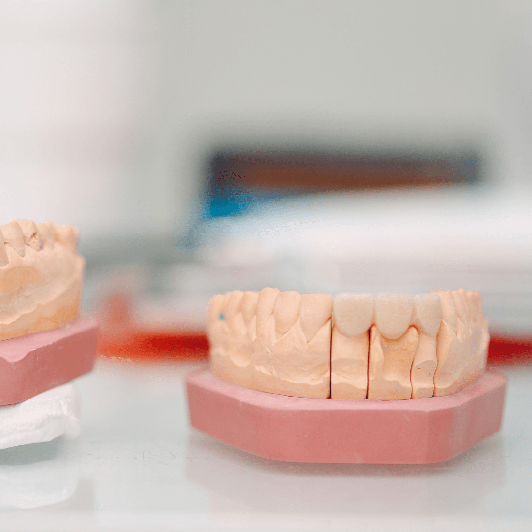 Atelier do Sorriso - Protese-min