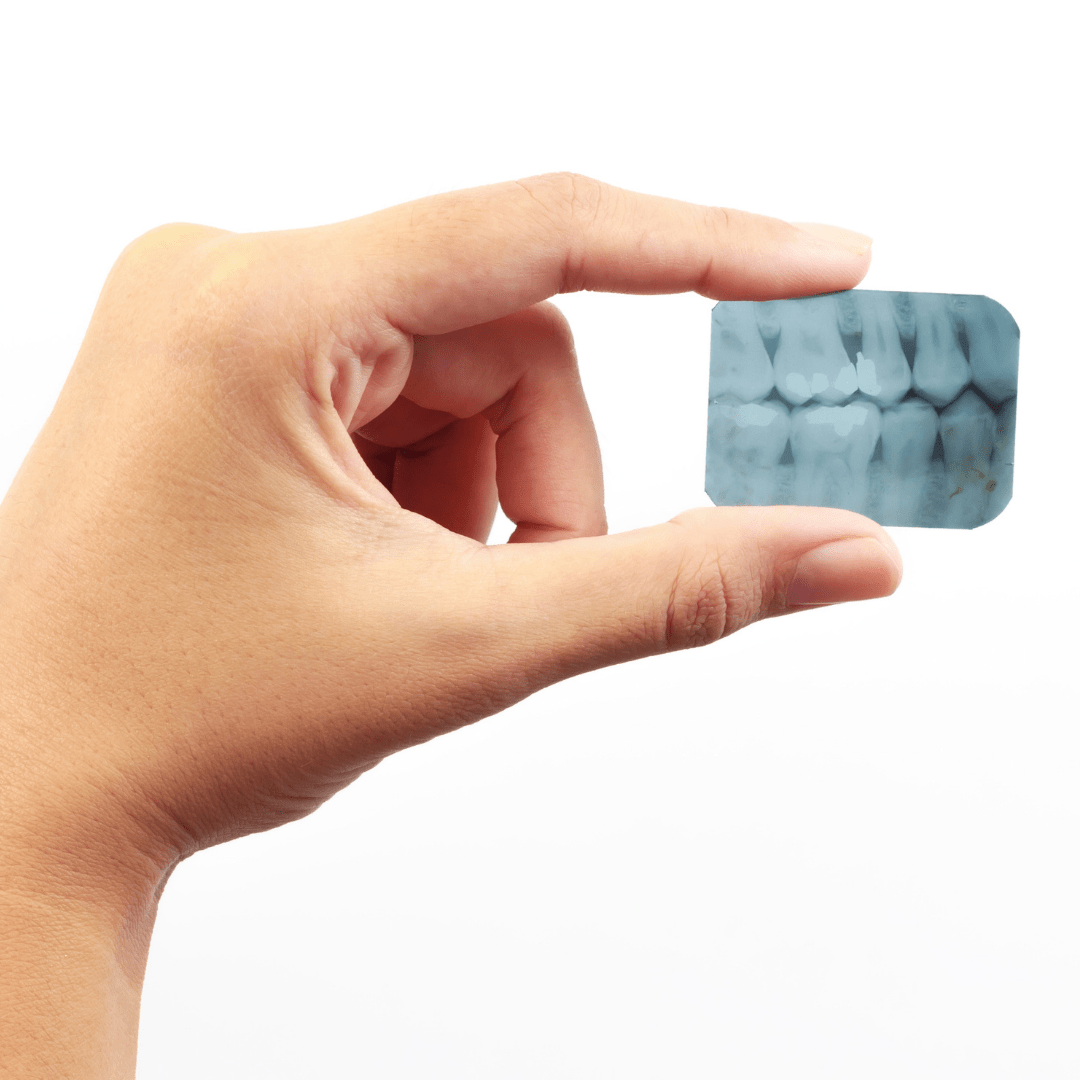 Atelier do Sorriso - Raiox-min